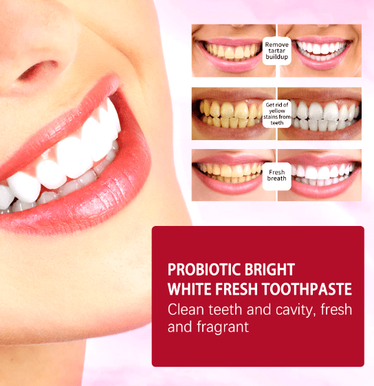 Probiotic Whitening Toothpaste (SP4)